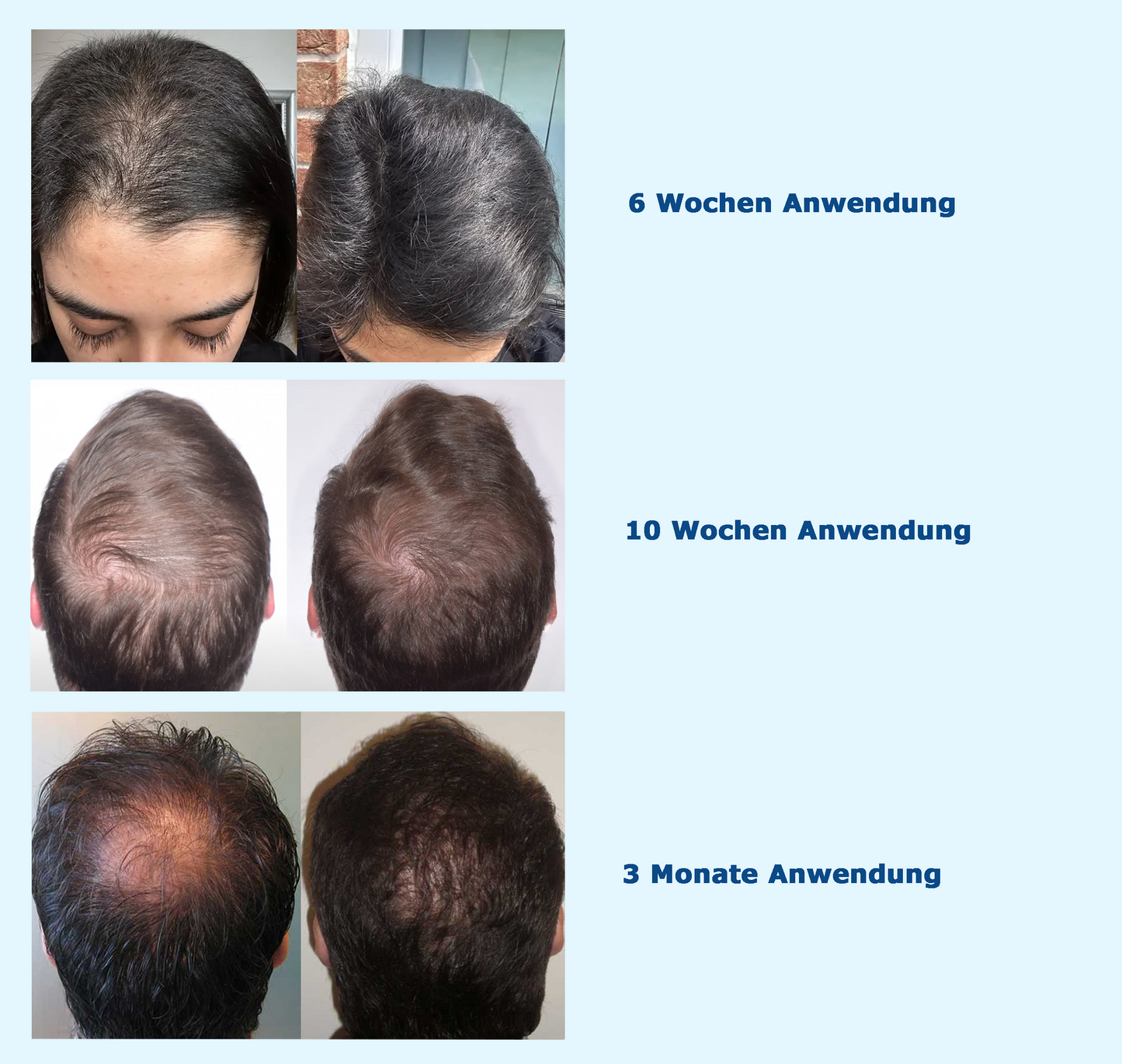 Wurzel Reaktivierungs Serum